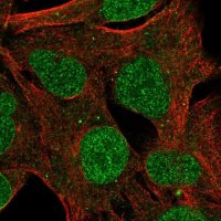 Anti-ZNF626 antibody produced in rabbit 