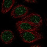 Anti-ZNF653 antibody produced in rabbit 