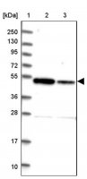 Anti-ZNF662 antibody produced in rabbit 