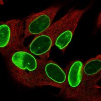 Anti-ZNF665 antibody produced in rabbit 