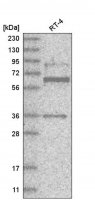 Anti-ZNF667 antibody produced in rabbit HPA030731-100UL