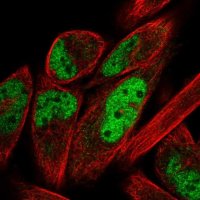 Anti-ZNF671 antibody produced in rabbit 