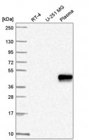 Anti-ZNF672 antibody produced in rabbit 