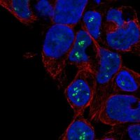 Anti-ZNF689 antibody produced in rabbit 