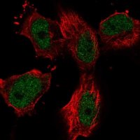 Anti-ZNF697 antibody produced in rabbit 