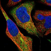 Anti-ZNF70 antibody produced in rabbit 