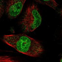 Anti-ZNF749 antibody produced in rabbit 