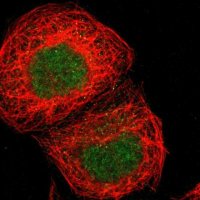 Anti-ZNF777 antibody produced in rabbit 