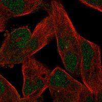 Anti-ZNF780B antibody produced in rabbit 