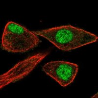 Anti-ZNF784 antibody produced in rabbit 