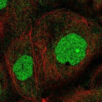 Anti-ZNF791 antibody produced in rabbit 