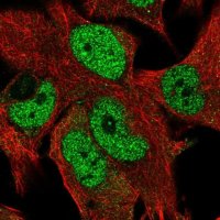 Anti-ZNF827 antibody produced in rabbit 