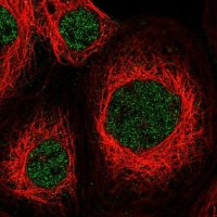Anti-ZNF83 antibody produced in rabbit 