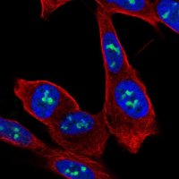 Anti-ZNF865 antibody produced in rabbit 