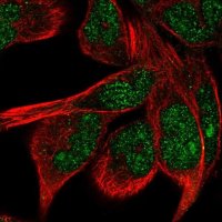 Anti-ZNF878 antibody produced in rabbit 