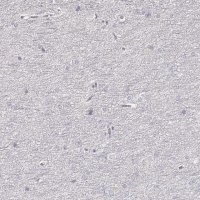 Anti-ZP3 antibody produced in rabbit 