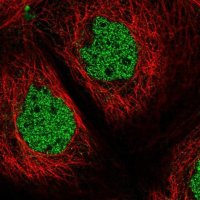 Anti-ZSCAN32 antibody produced in rabbit 