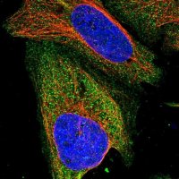 Anti-ZSWIM8 antibody produced in rabbit 