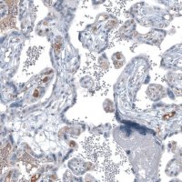 Monoclonal Anti-AFP antibody produced in mouse AMAB91610-100UL