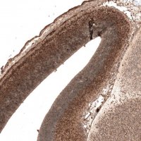 Monoclonal Anti-AUTS2 antibody produced in mouse 