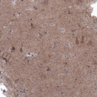 Monoclonal Anti-BRAF antibody produced in mouse 