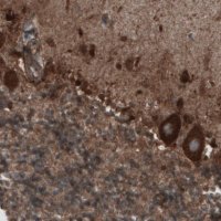 Monoclonal Anti-CARS antibody produced in mouse 