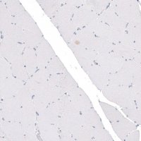 Monoclonal Anti-CDKL5 antibody produced in mouse 