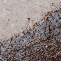 Monoclonal Anti-CNP antibody produced in mouse 