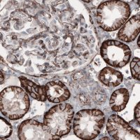 Monoclonal Anti-CTNNB1 antibody produced in mouse 