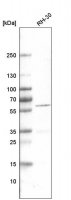 Monoclonal Anti-DES antibody produced in mouse 