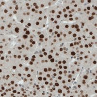 Monoclonal Anti-ERCC1 antibody produced in mouse 