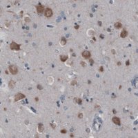 Monoclonal Anti-GORASP2 antibody produced in mouse 