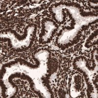 Monoclonal Anti-HIST1H3A antibody produced in mouse 