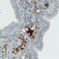 Monoclonal Anti-ITIH4 antibody produced in mouse 