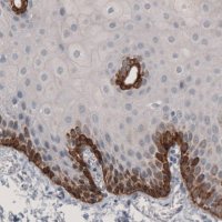 Monoclonal Anti-LAMB3 antibody produced in mouse 