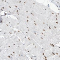 Monoclonal Anti-MEF2C antibody produced in mouse 