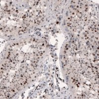 Monoclonal Anti-METTL14 antibody produced in mouse 