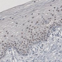 Monoclonal Anti-MKI67IP antibody produced in mouse 