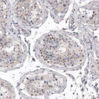 Monoclonal Anti-MKL1 antibody produced in mouse 