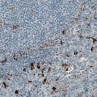 Monoclonal Anti-MMP9 antibody produced in mouse 