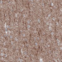 Monoclonal Anti-NEFL antibody produced in mouse 