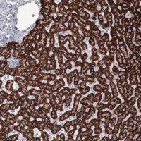 Monoclonal Anti-OTC antibody produced in mouse 
