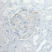 Monoclonal Anti-PLA2R1 antibody produced in mouse 