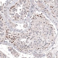 Monoclonal Anti-PRAME antibody produced in mouse 