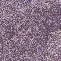 Monoclonal Anti-REST antibody produced in mouse 