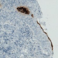 Monoclonal Anti-RNASE7 antibody produced in mouse 
