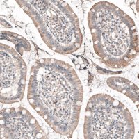 Monoclonal Anti-ROR2 antibody produced in mouse 