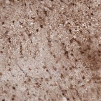 Monoclonal Anti-S100B antibody produced in mouse 