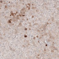 Monoclonal Anti-SAA1 antibody produced in mouse AMAB91543-100UL