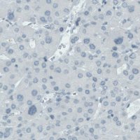 Monoclonal Anti-SLC27A5 antibody produced in mouse 